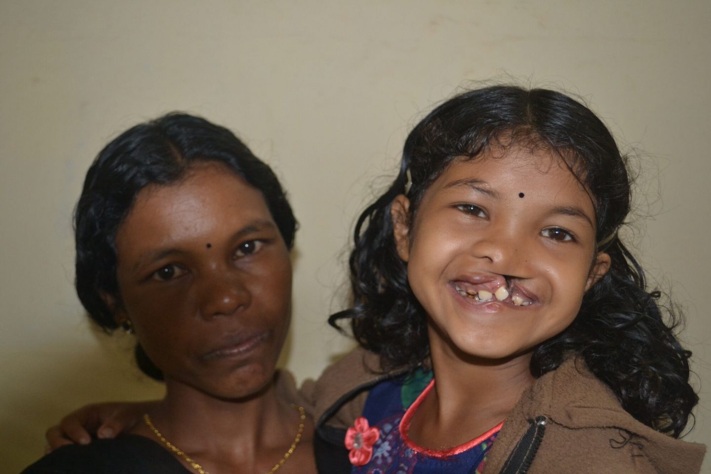 Soorya and her mother before the surgery for Soorya's cleft lip.